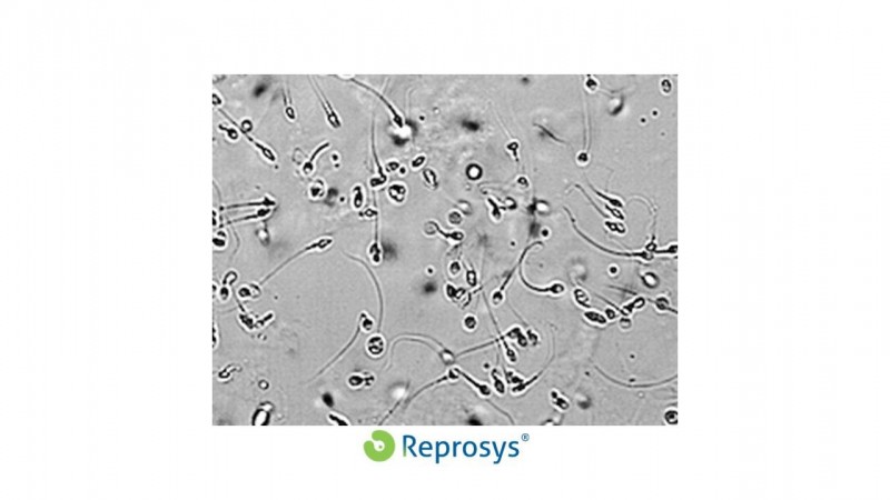 Yigitning jinsiy aloqa qilishiga yol qoymaydi